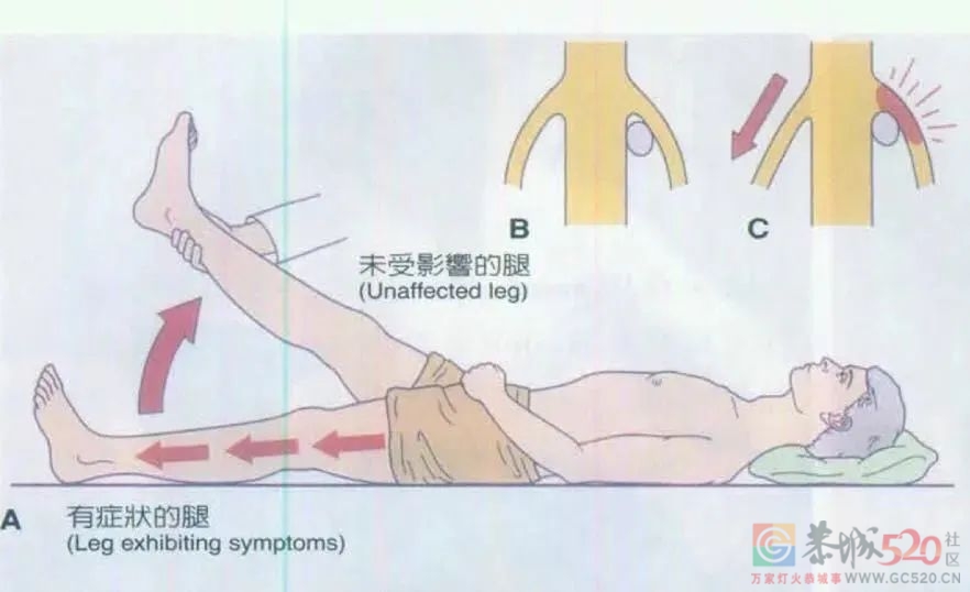 早上腰疼or晚上腰疼，骨科医生：原因不同……777 / 作者:健康小天使 / 帖子ID:298601