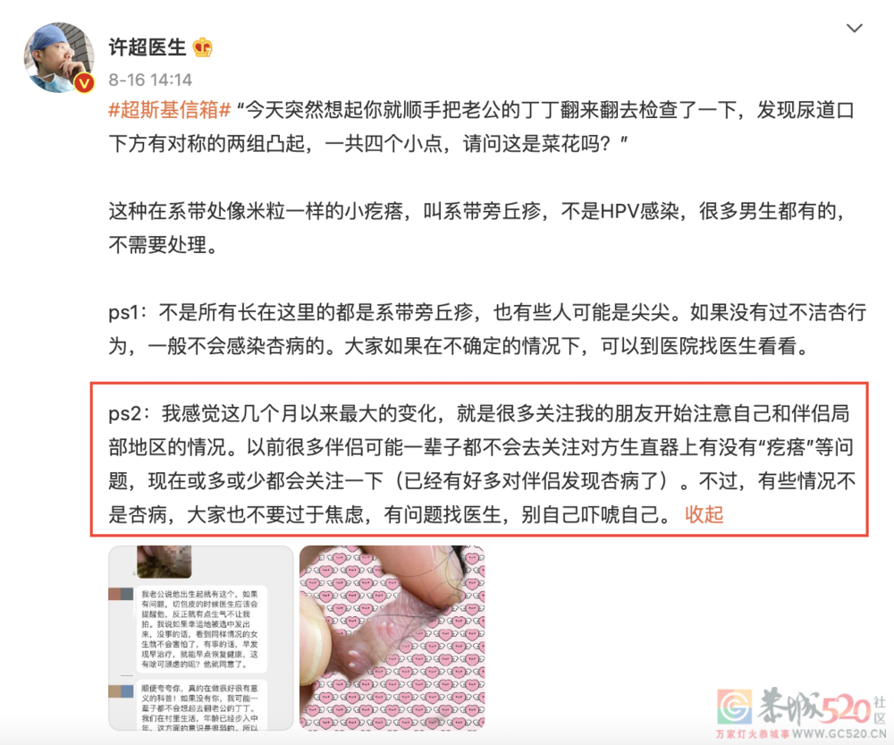 被“HPV焦虑”围猎的女孩们91 / 作者:儿时的回忆 / 帖子ID:298848