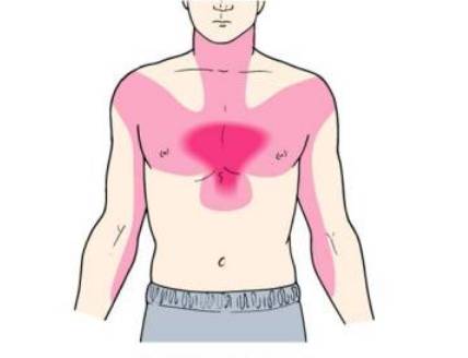 硝酸甘油、速效救心丸、阿司匹林……3种“救命药”怎么用？522 / 作者:健康小天使 / 帖子ID:299260