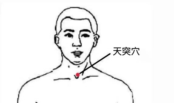 阳了咽喉痛可以“吃冰棍”缓解？先分清你是哪种痛382 / 作者:健康小天使 / 帖子ID:302763