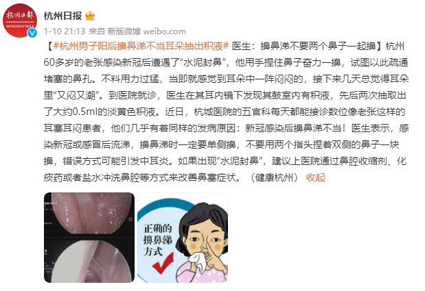 阳后出现“水泥封鼻”，医生最怕你这样擤鼻涕……744 / 作者:健康小天使 / 帖子ID:303295