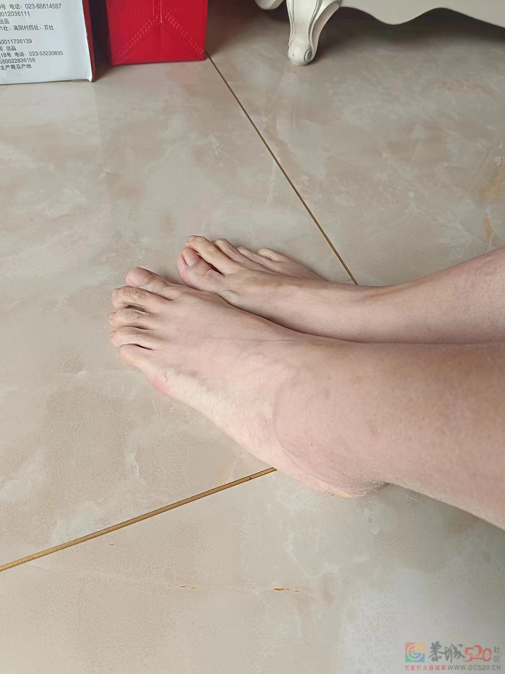 “我们也没想到，43码的脚，竟然是种病”819 / 作者:登山涉水 / 帖子ID:304641