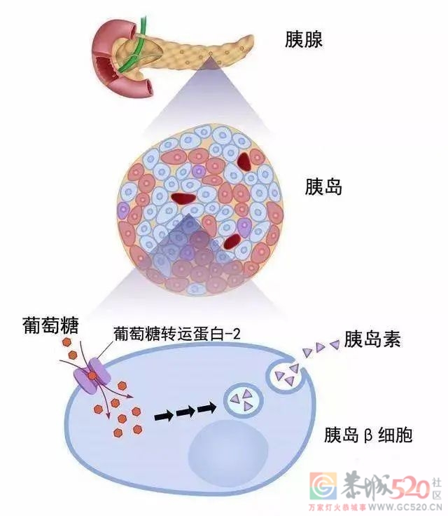 脖子上总有洗不掉的“泥”，你该查查血糖了571 / 作者:健康小天使 / 帖子ID:304723