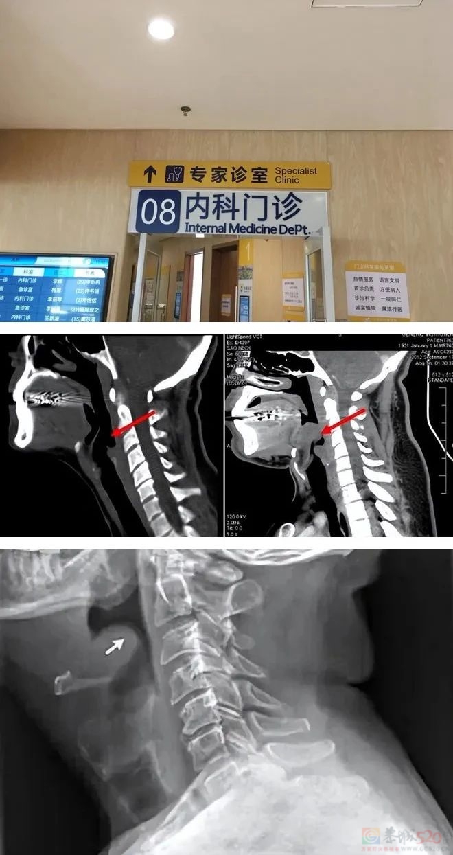 从就诊到去世仅10分钟，医生：这种嗓子疼很危险209 / 作者:健康小天使 / 帖子ID:307209