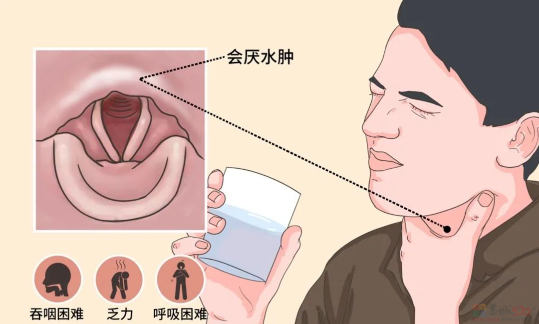 从就诊到去世仅10分钟，医生：这种嗓子疼很危险824 / 作者:健康小天使 / 帖子ID:307209