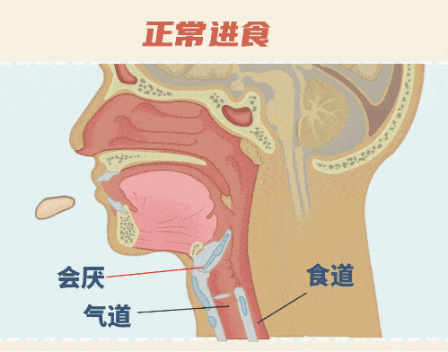 从就诊到去世仅10分钟，医生：这种嗓子疼很危险750 / 作者:健康小天使 / 帖子ID:307209