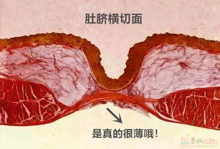 刻在中国人DNA里的习惯：天再热也要把肚子盖上555 / 作者:健康小天使 / 帖子ID:308066
