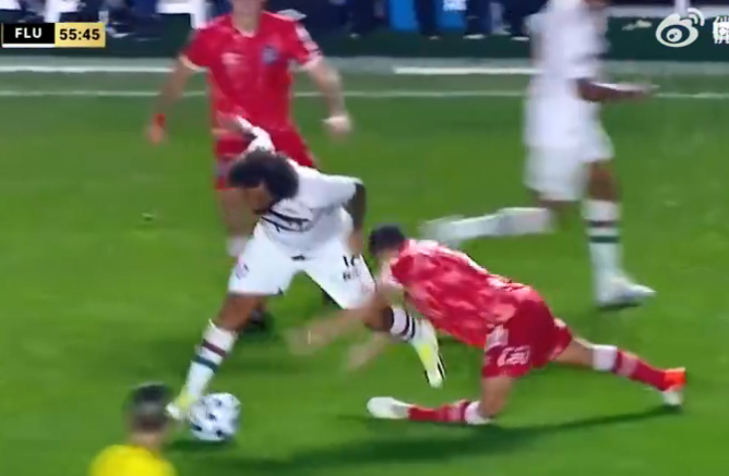 隔着屏幕都感觉疼。。。慎点！798 / 作者:圆月小侠 / 帖子ID:309047