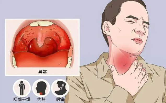 嗓子疼时喝什么有用？8种“饮品”上了推荐清单430 / 作者:健康小天使 / 帖子ID:312725