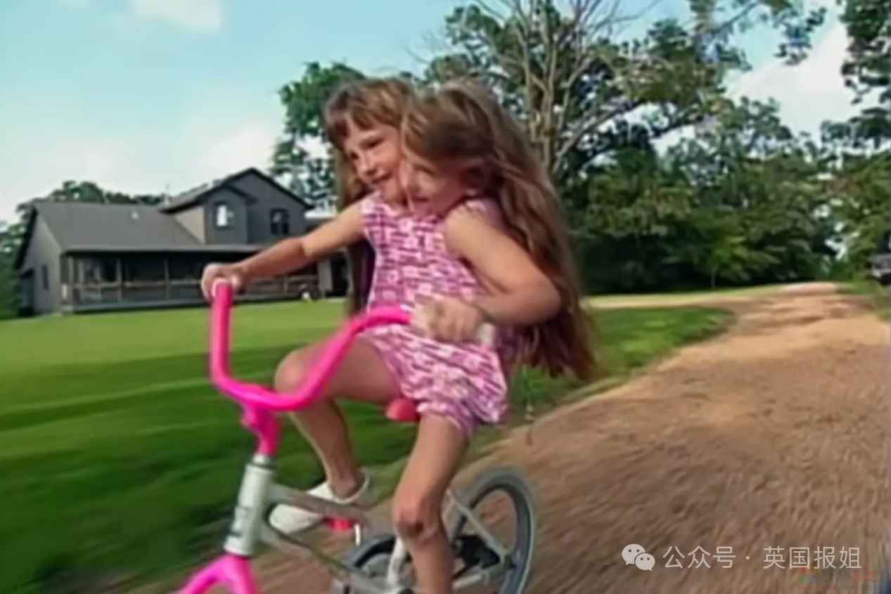 美国连体双胞胎嫁给同一个男人！共用身体34年，还要一起生孩子？354 / 作者:放眼看世界 / 帖子ID:314448