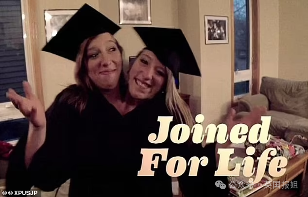 美国连体双胞胎嫁给同一个男人！共用身体34年，还要一起生孩子？130 / 作者:放眼看世界 / 帖子ID:314448