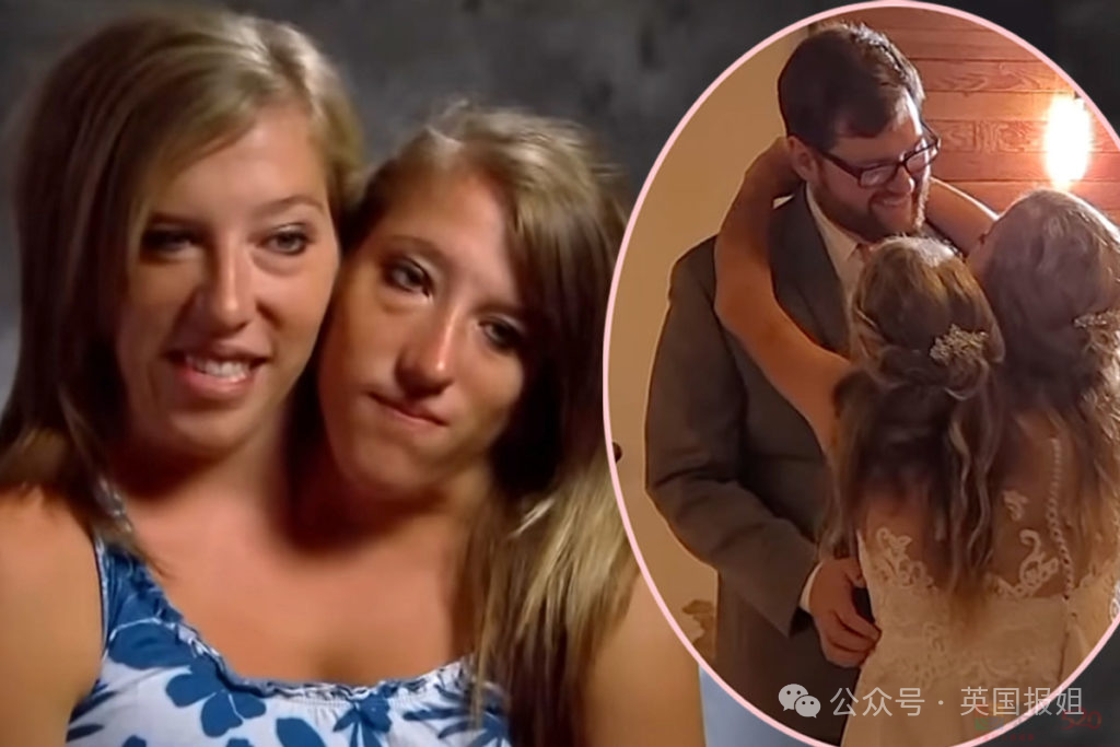 美国连体双胞胎嫁给同一个男人！共用身体34年，还要一起生孩子？464 / 作者:放眼看世界 / 帖子ID:314448