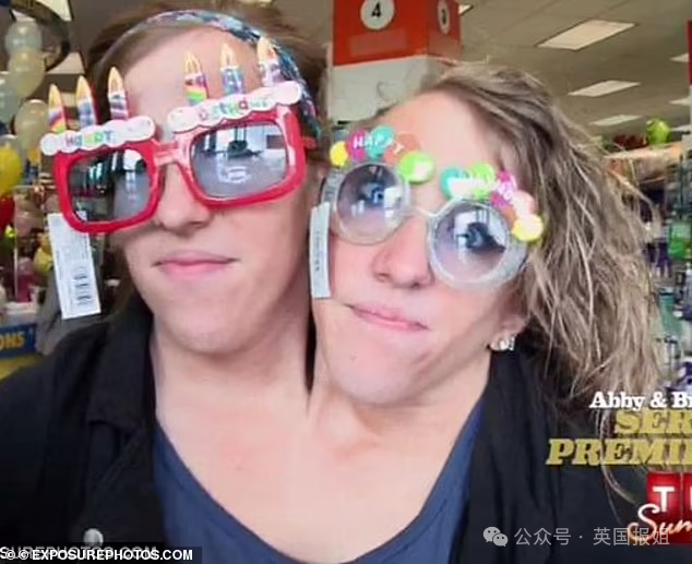 美国连体双胞胎嫁给同一个男人！共用身体34年，还要一起生孩子？199 / 作者:放眼看世界 / 帖子ID:314448