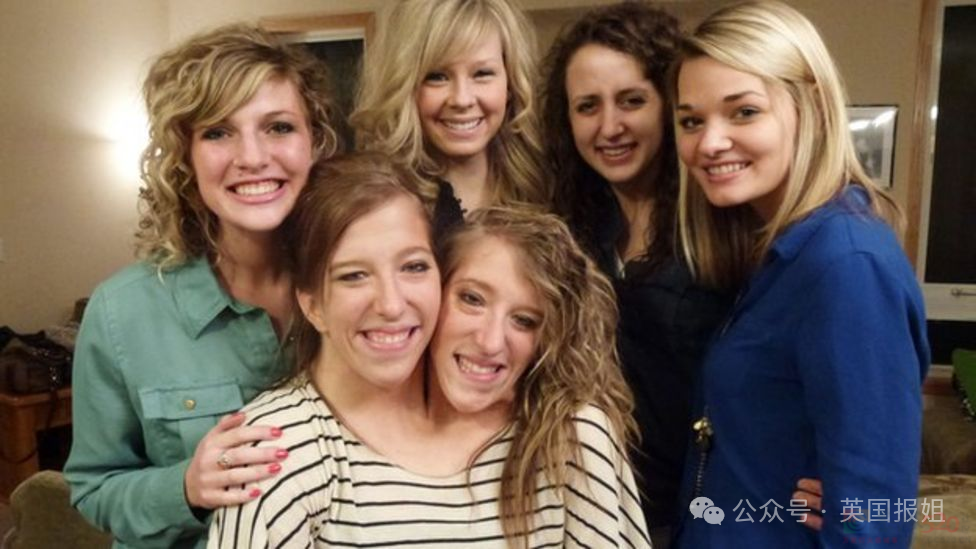 美国连体双胞胎嫁给同一个男人！共用身体34年，还要一起生孩子？522 / 作者:放眼看世界 / 帖子ID:314448