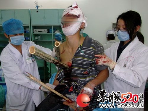 临桂一男子被多根竹子扎成刺猬 生死未卜378 / 作者:勇哥 / 帖子ID:4226