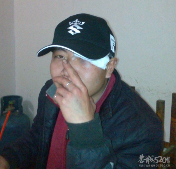 酱紫受伤最新消息（有图为证）199 / 作者:糖果盒子 / 帖子ID:9383