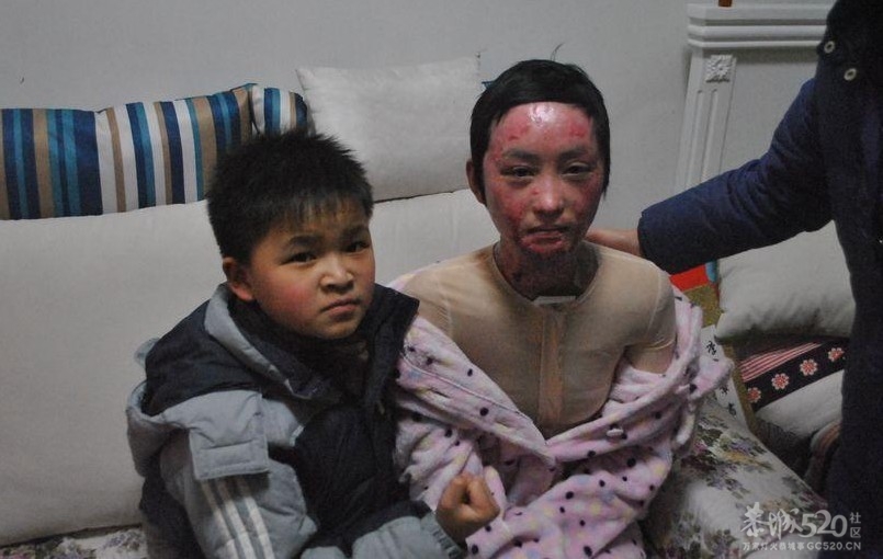 抗震救灾小英雄林浩看望并鼓励周岩【组图】596 / 作者:黄子 / 帖子ID:10886