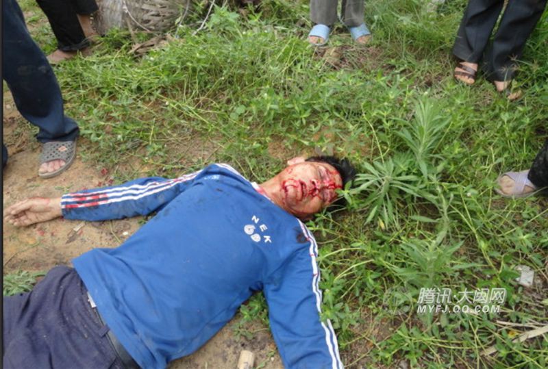 血淋的事实，这事是真的吗？？？962 / 作者:梦里探花 / 帖子ID:17745