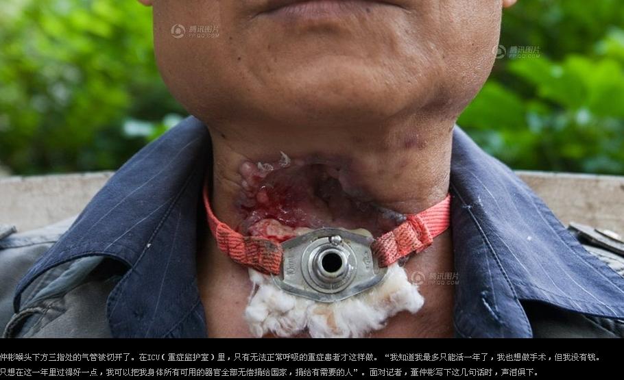 男子无偿献血48次患癌没钱、、、、、、、、、847 / 作者:流落民间的记者 / 帖子ID:18745