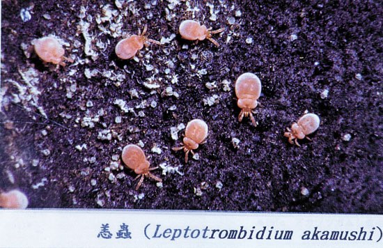 广州发现疑似恙虫病巳死亡二人。517 / 作者:平安大叔 / 帖子ID:18751