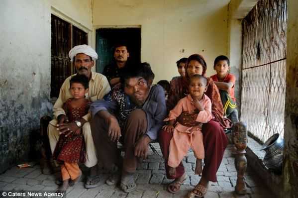 巴基斯坦惊现真实版“象人”415 / 作者:美特斯邦威 / 帖子ID:19548