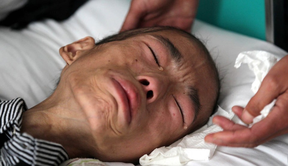 17岁癌症少年无钱治疗 含泪捐全身器官540 / 作者:小雨点 / 帖子ID:20166