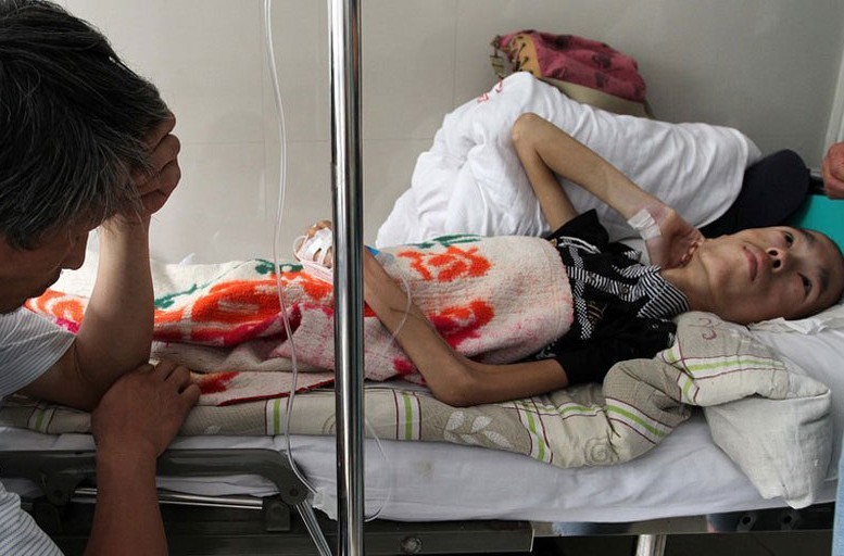 17岁癌症少年无钱治疗 含泪捐全身器官807 / 作者:小雨点 / 帖子ID:20166