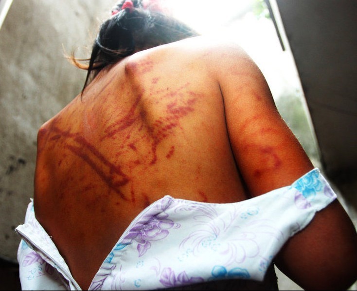 常州9岁哥哥毒打虐待亲生妹妹242 / 作者:小雨点 / 帖子ID:20600