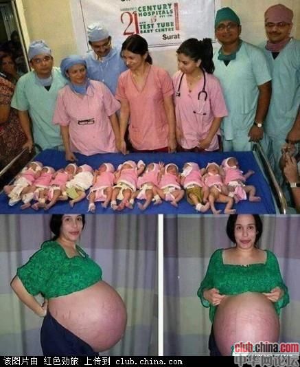 印度一妇人一次性产下一支足球队695 / 作者:否定一切 / 帖子ID:21537