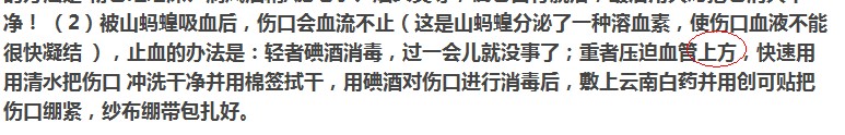 夏天来了,户外活动 如何预防山蚂蝗！791 / 作者:马路桥~八区 / 帖子ID:21531