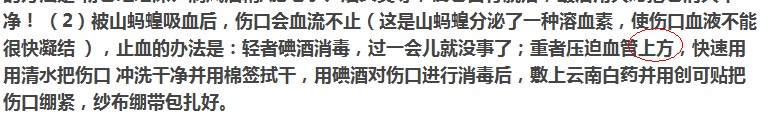 夏天来了,户外活动 如何预防山蚂蝗！796 / 作者:马路桥~八区 / 帖子ID:21531