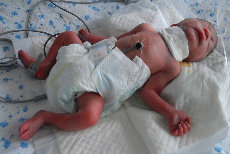 组图：辽宁新生女婴遭割喉被弃垃圾桶607 / 作者:小雨点 / 帖子ID:22755