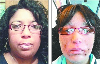 一女子全身毛囊不长毛长指甲你怕不怕？825 / 作者:平安大叔 / 帖子ID:27001