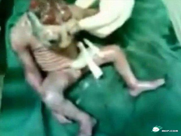 国外一妇产下怪胎疑为亿年前生物825 / 作者:翠微瑶人 / 帖子ID:35691