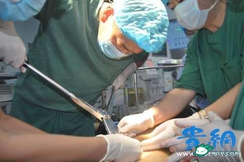 男子生殖器套金戒指 消防用老虎钳取下(图)301 / 作者:俗人 / 帖子ID:38181