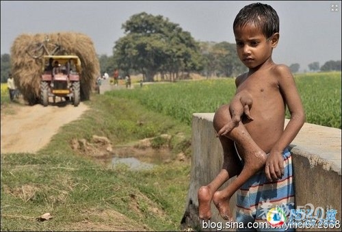 世界之最170 / 作者:柳艳 / 帖子ID:58351