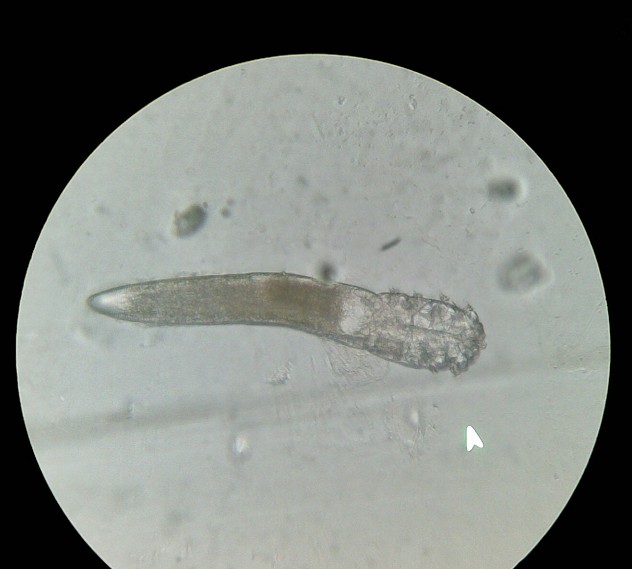 皮肤蠕形螨放大400倍后的样子886 / 作者:马路桥~八区 / 帖子ID:68228