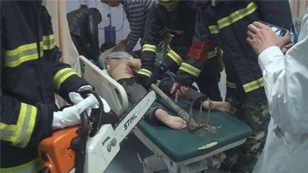 男子酒后翻墙回家 木棍插进肛门近二十公分(435 / 作者:狗掰涛 / 帖子ID:96607