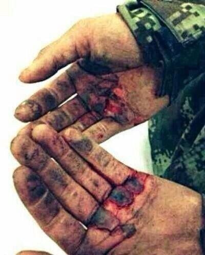 （致：消防战士）你们用生命守护着人民，可谁来守护你们！723 / 作者:坚强的硬汉 / 帖子ID:101655