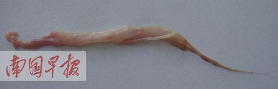 辟谣“猪肉虫”实为血管组织 请转发让更多的人知道777 / 作者:UYY555 / 帖子ID:101718