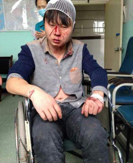 河南城管持砖石群殴村民 恭城的城管算文明的拉163 / 作者:红通通 / 帖子ID:105148