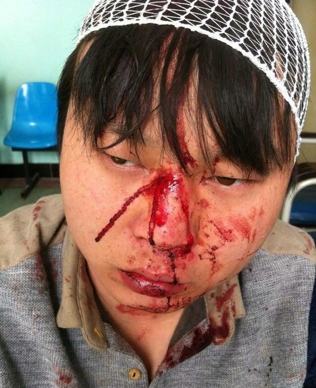 河南城管持砖石群殴村民 恭城的城管算文明的拉184 / 作者:红通通 / 帖子ID:105148