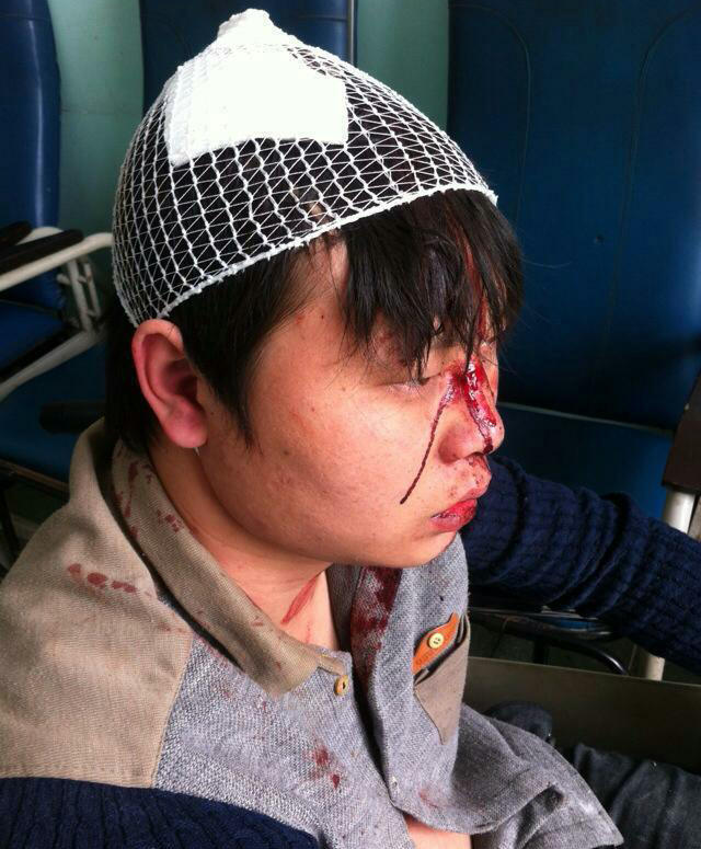 河南城管持砖石群殴村民 恭城的城管算文明的拉979 / 作者:红通通 / 帖子ID:105148