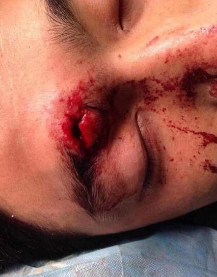 河南城管持砖石群殴村民 恭城的城管算文明的拉95 / 作者:红通通 / 帖子ID:105148