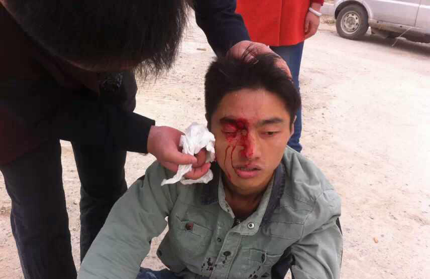 河南城管持砖石群殴村民 恭城的城管算文明的拉242 / 作者:红通通 / 帖子ID:105148