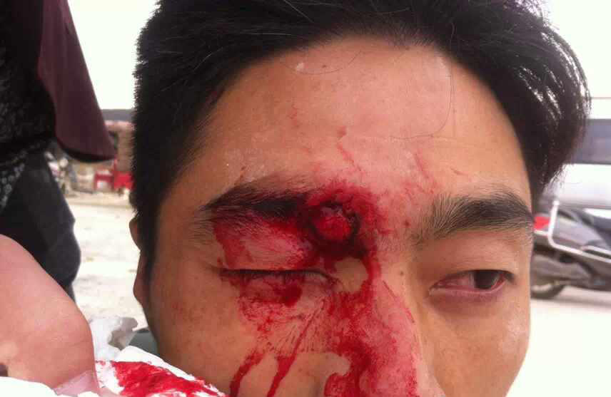 河南城管持砖石群殴村民 恭城的城管算文明的拉501 / 作者:红通通 / 帖子ID:105148