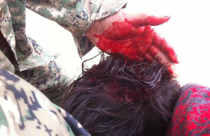 河南城管持砖石群殴村民 恭城的城管算文明的拉143 / 作者:红通通 / 帖子ID:105148