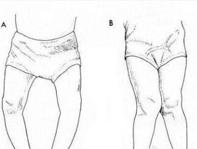 翘二郎腿等于慢性自杀688 / 作者:美丽的梦花 / 帖子ID:105673