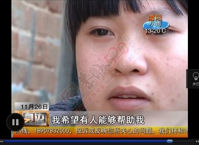 莲花崇岭因病失学女孩李雨琼有救了——桂林电视台《身边》播出之后引来转机942 / 作者:北辰 / 帖子ID:106117