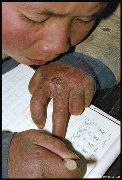 你有勇气看完这些相片吗994 / 作者:蓝天鱼儿 / 帖子ID:106128